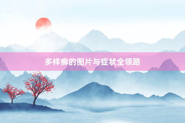 多样癣的图片与症状全领路